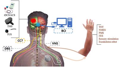 Editorial: Novel technologies targeting the rehabilitation of neurological disorders